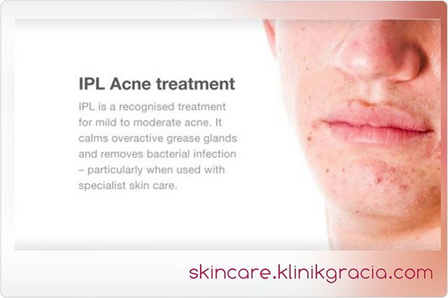 Apa itu IPL Acne??? - Gracia Skin Care