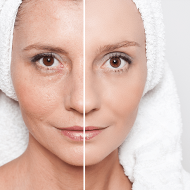 micropeel-beauty-treatment-klinik-gracia-skin-care micropeel-beauty-treatment-klinik-gracia-skin-care