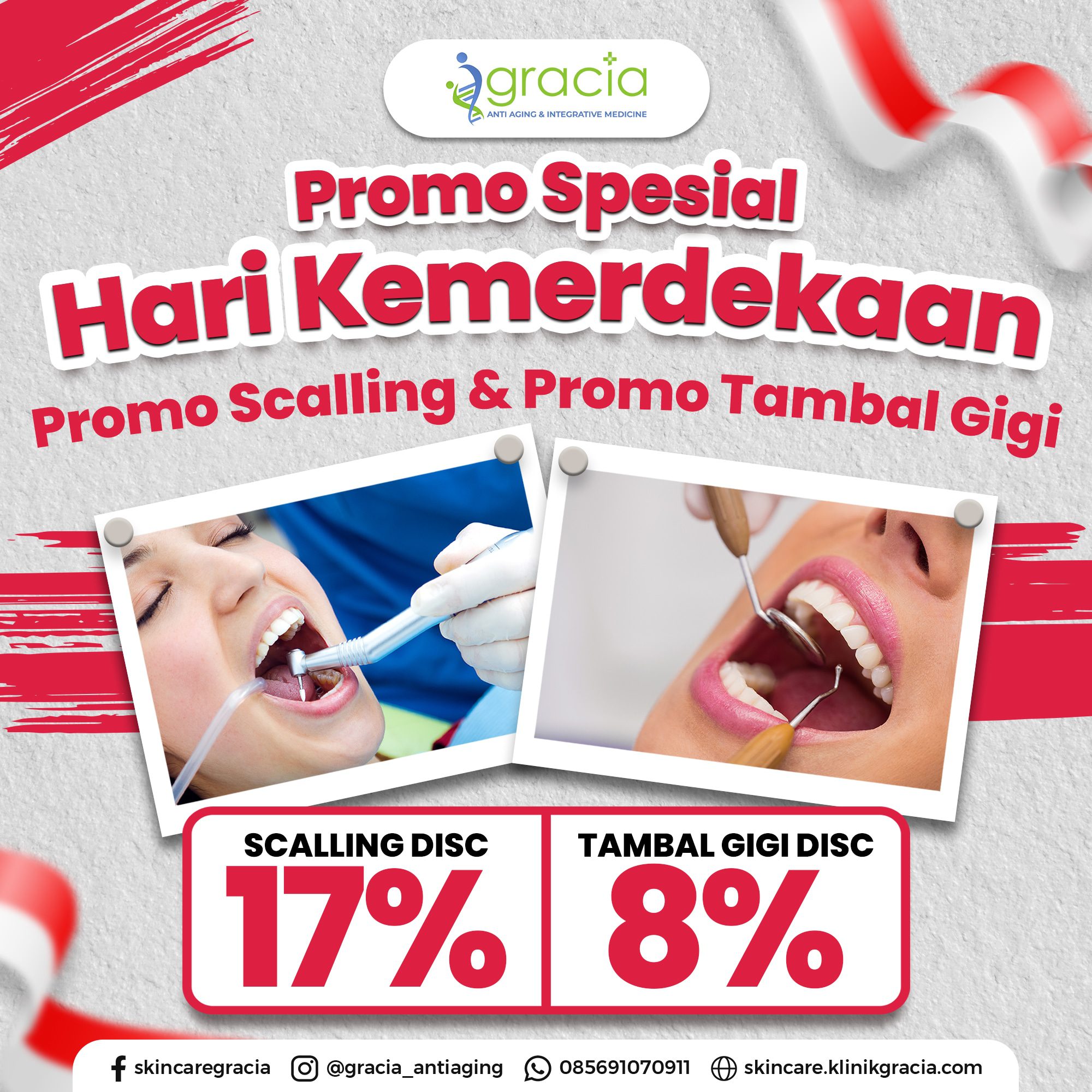 Post promo gigi 2