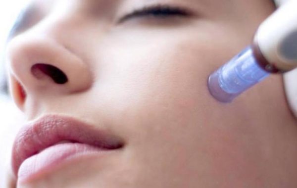 microneedling-dermapen-dermaroller-treatment