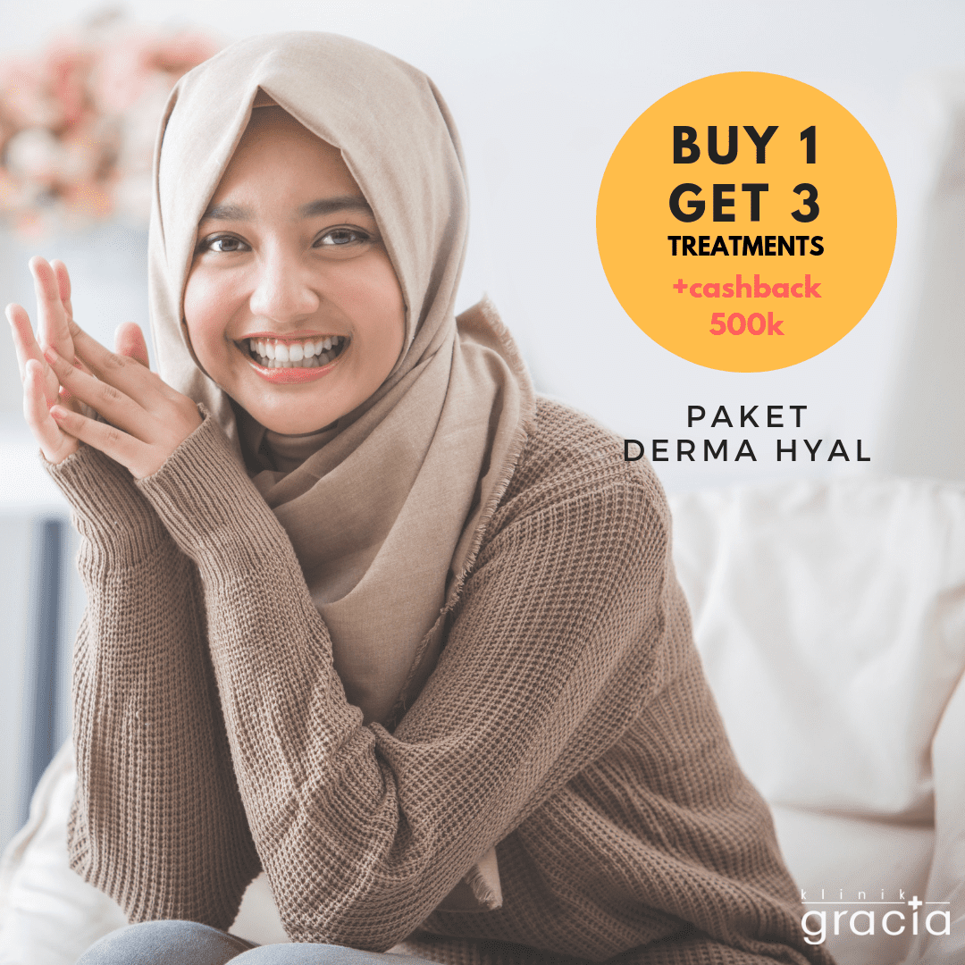 buy1get3_2