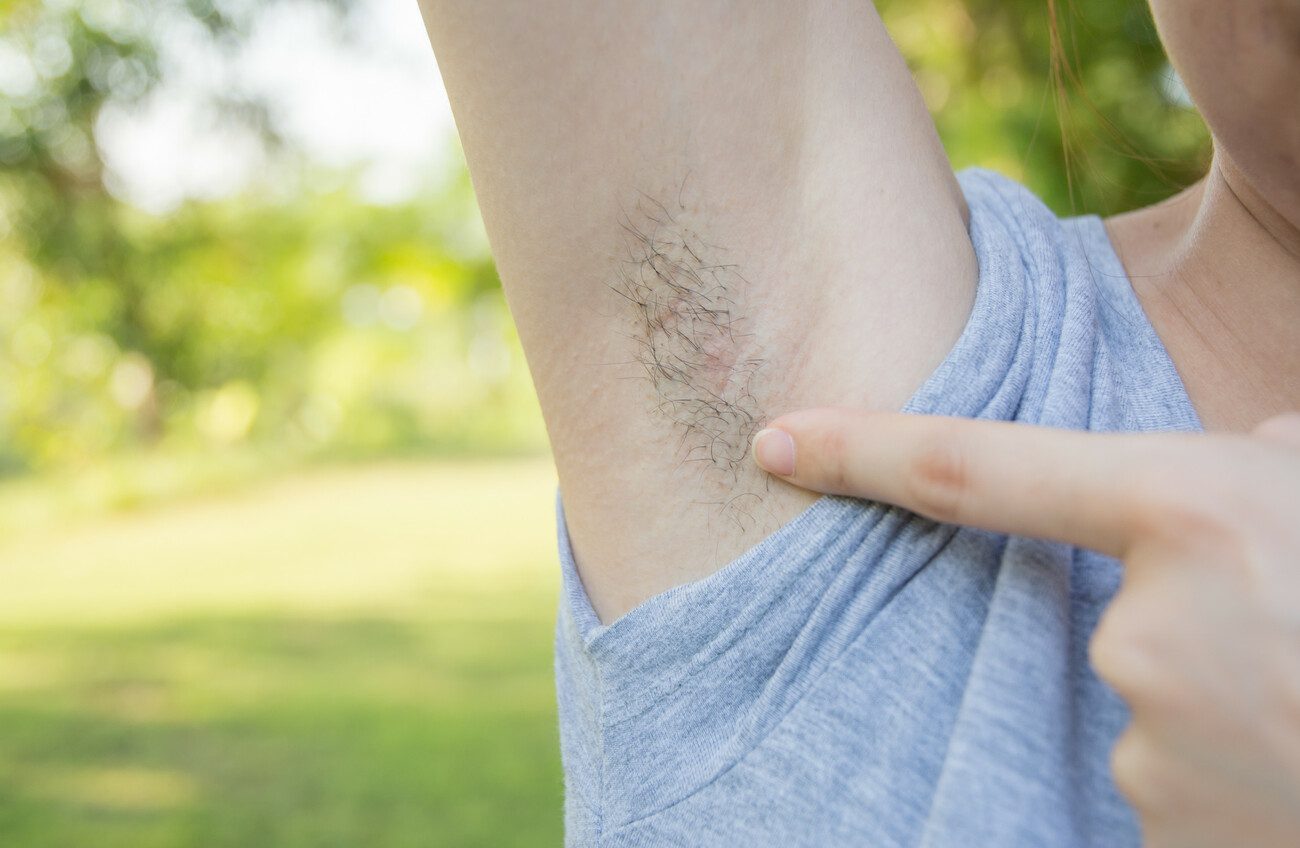underarm
